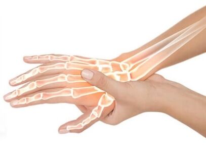 Etkilenen bölgeye Hondrox uygulanır