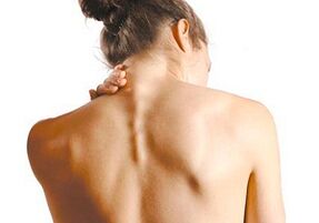 Servikal osteokondroz nasıl tezahür edilir