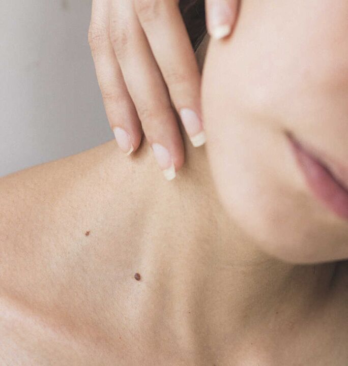 Boyundaki sertlik, servikal omurganın osteokondrozunun ilk aşamasının semptomlarından biridir.