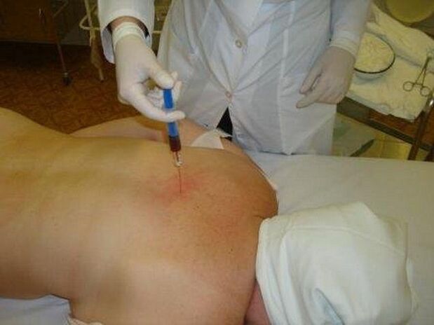 Osteokondroz için ilaçlar