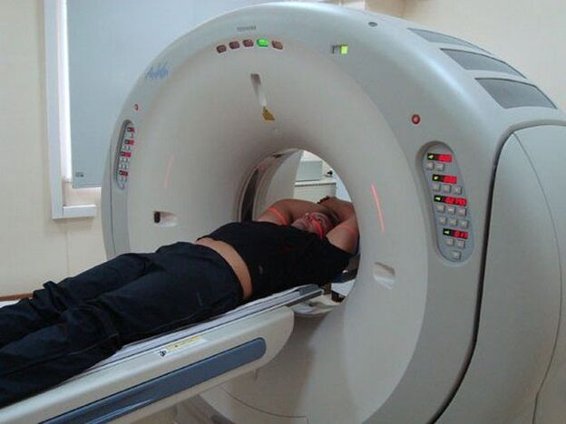 osteokondroz tanısı