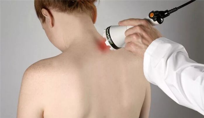 servikal osteokondroz tedavisi için fizyoterapi