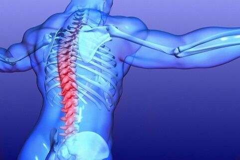 lomber omurganın osteokondrozu