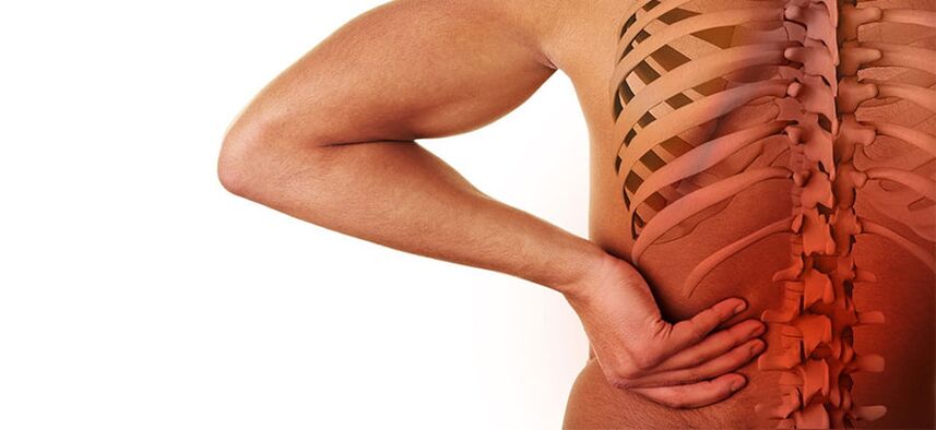 lomber osteokondroz belirtileri